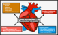cardiomyopathy graphic